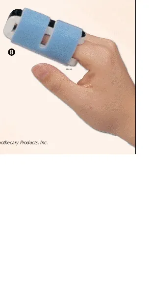 Finger Splint Medium Hook and Loop Closure Left Hand