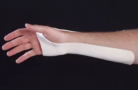 Wrist Splint Ulnar Gutter Multi-Form Plastic Left or Right Hand White Small / Medium
