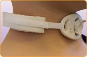 Tracheostomy Tube Collar