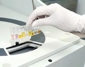 Reagent Kit Pointe™ General Chemistry Alkaline Phosphatase (ALP) For Clinical Chemistry Analyzers R1: 1 X 120 mL, R2: 1 X 30 mL